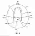 Fig. 03 - Altering the stiffness, size and/or shape of tissues for breathing disorders and other conditions
