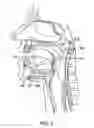 Fig. 04 - Altering the stiffness, size and/or shape of tissues for breathing disorders and other conditions