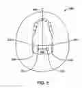 Fig. 07 - Altering the stiffness, size and/or shape of tissues for breathing disorders and other conditions