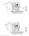 Fig. 09 - Altering the stiffness, size and/or shape of tissues for breathing disorders and other conditions
