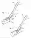 Fig. 07 - Suture based vascular closure apparatus and method incorporating a pre-tied knot
