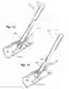 Fig. 08 - Suture based vascular closure apparatus and method incorporating a pre-tied knot