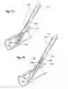 Fig. 09 - Suture based vascular closure apparatus and method incorporating a pre-tied knot