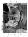 Fig. 27 - Removable closure system and plug for conduit