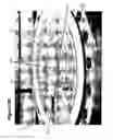 Fig. 29 - Removable closure system and plug for conduit