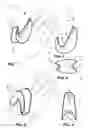 Fig. 02 - Hand shield