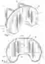 Fig. 02 - Adjustable head support
