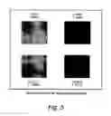 Fig. 06 - Water-fat separation for fast spin echo imaging in an inhomogeneous field with progressive encoding