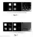 Fig. 07 - Water-fat separation for fast spin echo imaging in an inhomogeneous field with progressive encoding