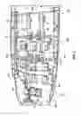 Fig. 03 - Cervical-thoracic-lumbar spine phased array coil for Magnetic Resonance Imaging