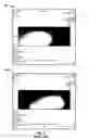 Fig. 04 - Cervical-thoracic-lumbar spine phased array coil for horizontal field MRI systems