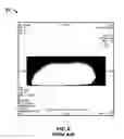 Fig. 05 - Cervical-thoracic-lumbar spine phased array coil for horizontal field MRI systems