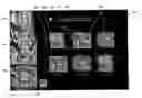 Fig. 01 - User-interface and method for curved multi-planar reformatting of three-dimensional volume data sets