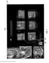 Fig. 09 - User-interface and method for curved multi-planar reformatting of three-dimensional volume data sets