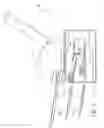 Fig. 09 - Recording element printing and treating system and method