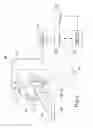 Fig. 03 - Method and apparatus for reduction of artifacts in computed tomography images