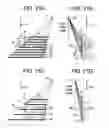 Fig. 12 - Three-dimensional backprojection method and apparatus, and X-ray CT apparatus