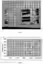Fig. 02 - X-ray arrangement and x-ray contrast process for imaging an object under examination that contains at least one radiopaque element as well as use of the x-ray arrangement