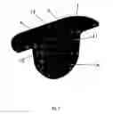 Fig. 06 - Hearing aid with a microphone in the battery compartment lid