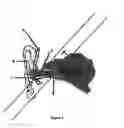 Fig. 02 - Dispensing of hearing aids