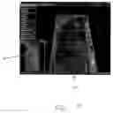 Fig. 08 - Systems and methods relating to AFIS recognition, extraction, and 3-D analysis strategies