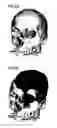 Fig. 07 - Method and image processing system for segmentation of section image data