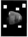 Fig. 04 - Composition and method for prevention and treatment of dental caries
