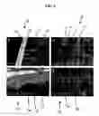 Fig. 05 - Composition and method for prevention and treatment of dental caries
