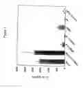 Fig. 02 - Monocyte-derived dendritic cell subsets