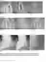 Fig. 02 - Compositions and methods for the management of hyperproliferative dermatological conditions
