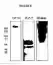 Fig. 09 - Lipoparticles comprising proteins, methods of making, and using the same