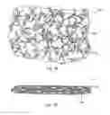 Fig. 02 - Compressed high density fibrous polymers suitable for implant