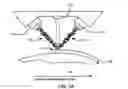 Fig. 04 - Laser based metal deposition of implant structures