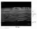 Fig. 07 - Laser based metal deposition of implant structures