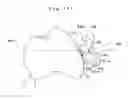 Fig. 08 - Orthodontic bracket