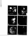 Fig. 02 - Compositions and methods for treating cells having double minute DNA