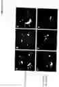 Fig. 05 - Compositions and methods for treating cells having double minute DNA