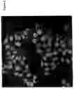 Fig. 10 - Compositions and methods for treating cells having double minute DNA