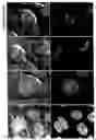 Fig. 14 - Compositions and methods for treating cells having double minute DNA
