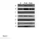 Fig. 04 - Method for the selection of compounds useful for the treatment of huntington's disease