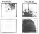 Fig. 07 - Method for the detection of osteoarthritis related gene transcripts in blood