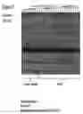 Fig. 12 - Method for the detection of osteoarthritis related gene transcripts in blood
