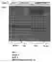Fig. 14 - Method for the detection of osteoarthritis related gene transcripts in blood