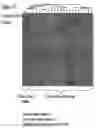 Fig. 20 - Method for the detection of osteoarthritis related gene transcripts in blood