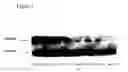 Fig. 12 - Identification of novel targets for radio sensitization using a genomic-based radiation sensitivity classifier