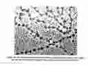 Fig. 23 - Mastitis detection