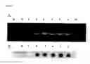 Fig. 12 - Method for amplifying nucleic acid sequence