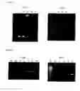 Fig. 14 - Method for amplifying nucleic acid sequence