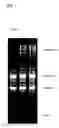 Fig. 04 - RNA extraction method, RNA extraction reagent, and method for analyzing biological materials