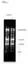 Fig. 05 - RNA extraction method, RNA extraction reagent, and method for analyzing biological materials